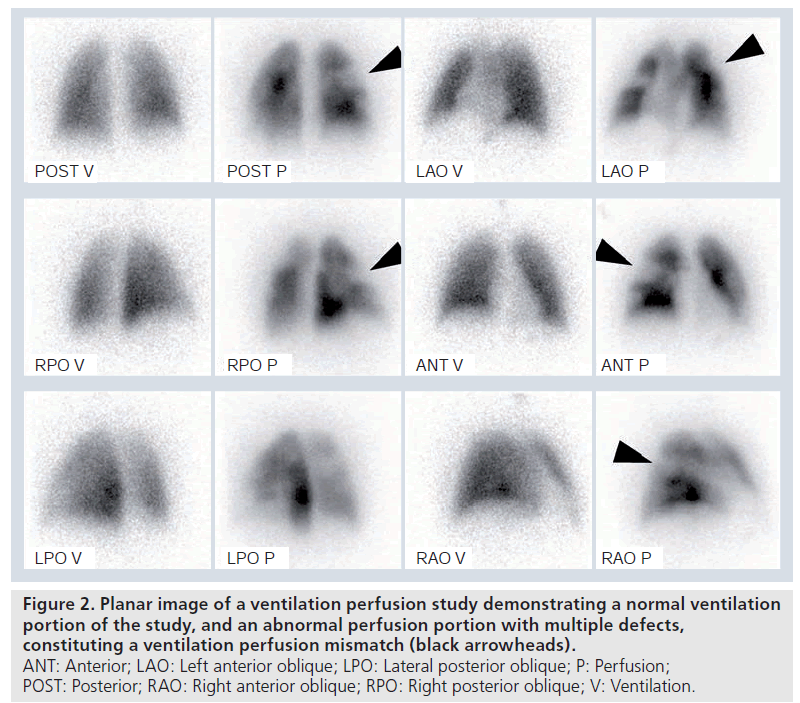 imaging-in-medicine-posterior-oblique