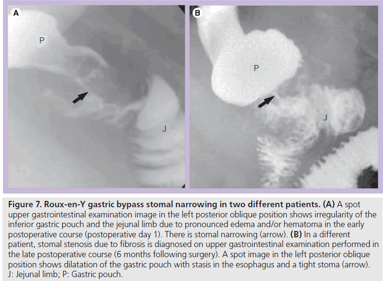 imaging-in-medicine-posterior-oblique