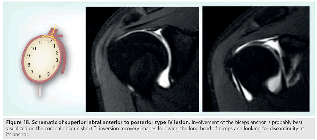 imaging-in-medicine-posterior-type