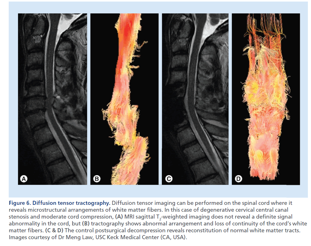imaging-in-medicine-postsurgical-decompression
