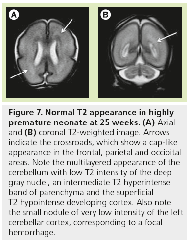 imaging-in-medicine-premature-neonate