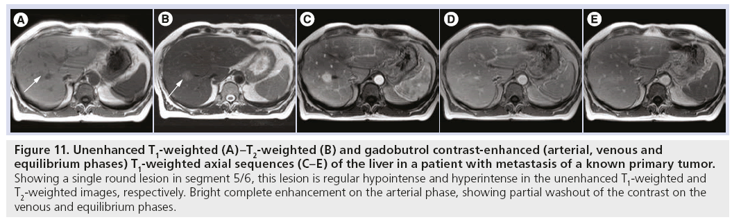 imaging-in-medicine-primary-tumor