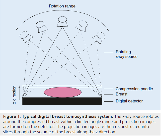 imaging-in-medicine-projection-images