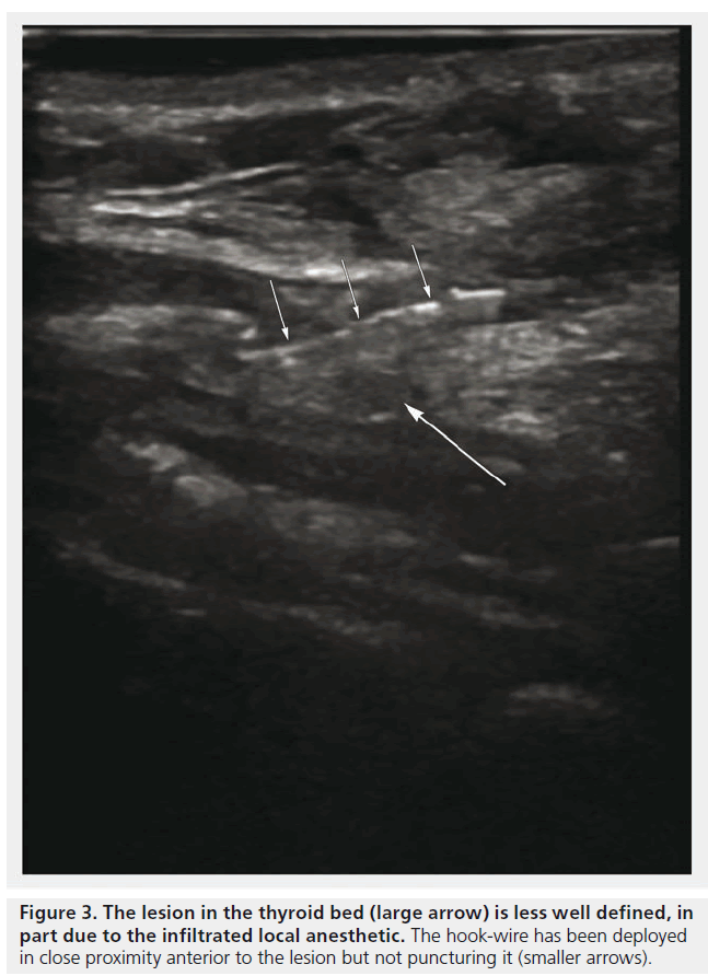 imaging-in-medicine-proximity-anterior