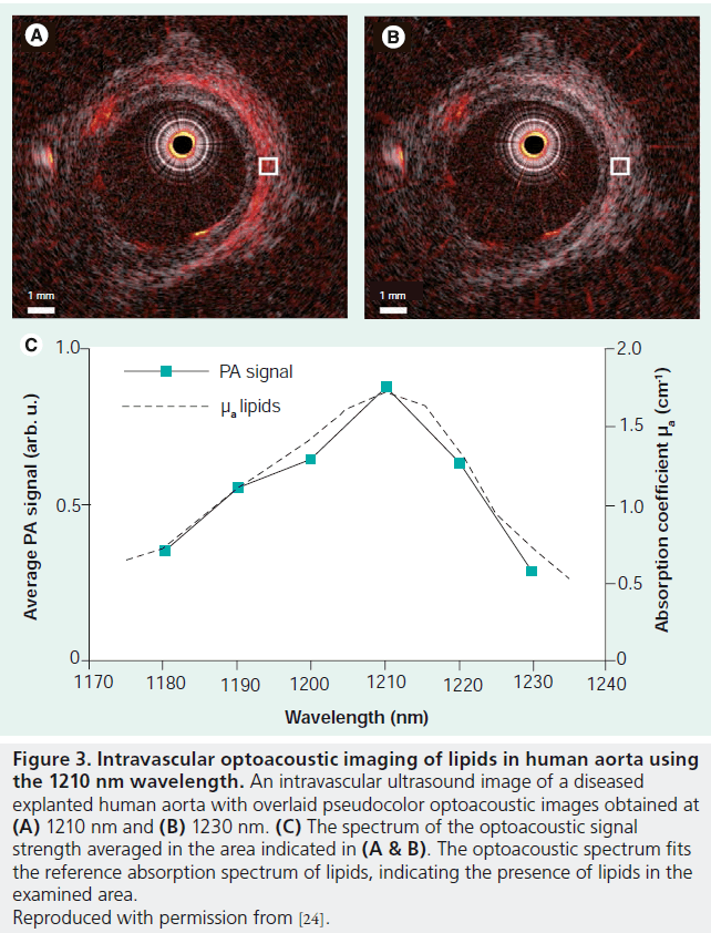 imaging-in-medicine-pseudocolor-optoacoustic