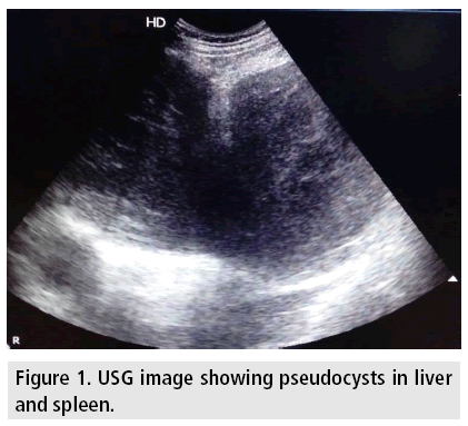 imaging-in-medicine-pseudocysts