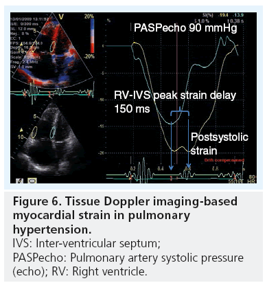 Frontiers  The Predictive Value of Right Ventricular Longitudinal Strain  in Pulmonary Hypertension, Heart Failure, and Valvular Diseases