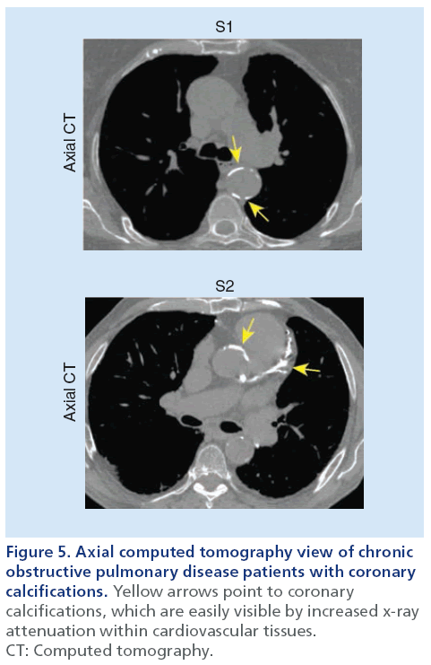 imaging-in-medicine-pulmonary-disease