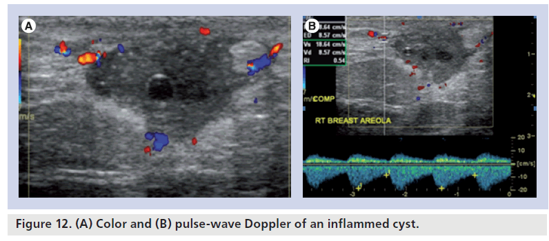 imaging-in-medicine-pulse-wave
