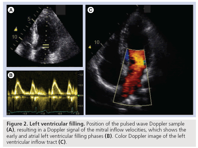 Future applications of strain imaging