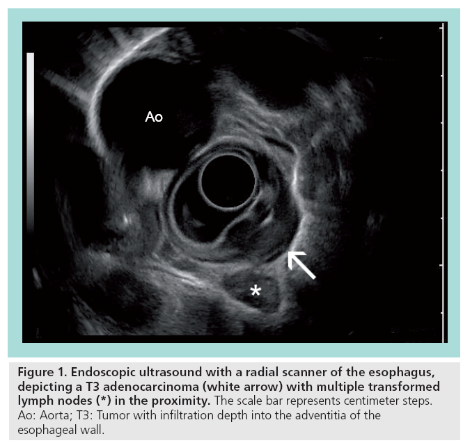 imaging-in-medicine-radial-scanner