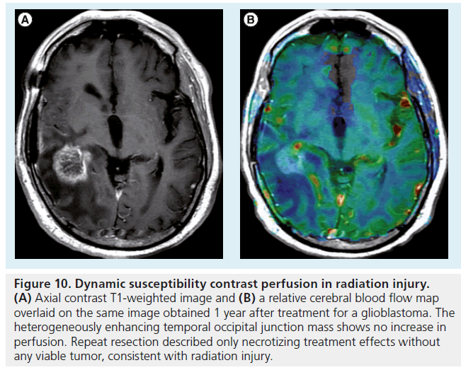 imaging-in-medicine-radiation-injury