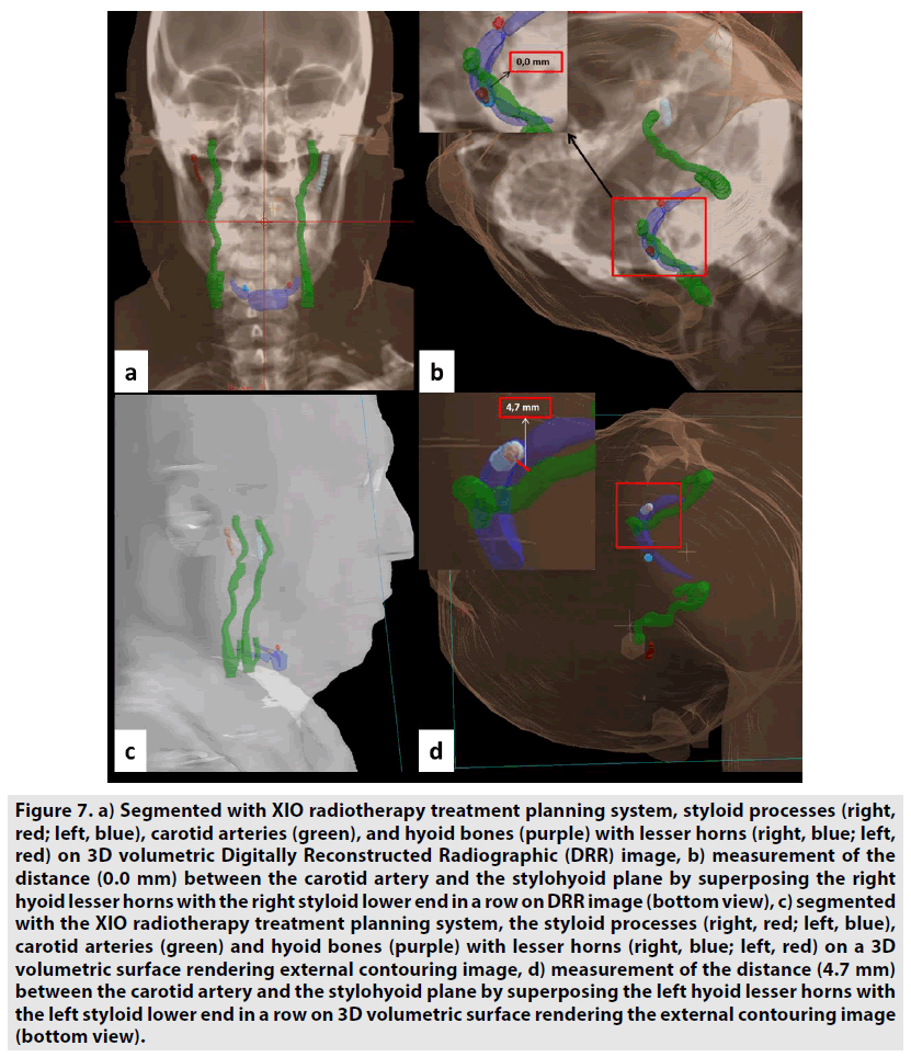 imaging-in-medicine-radiotherapy-treatment