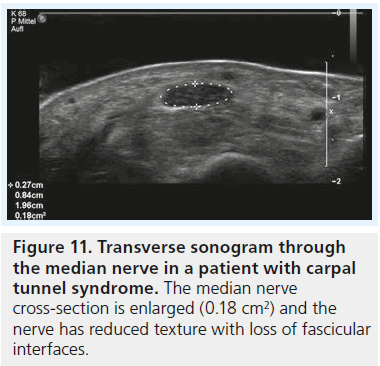 imaging-in-medicine-reduced-texture