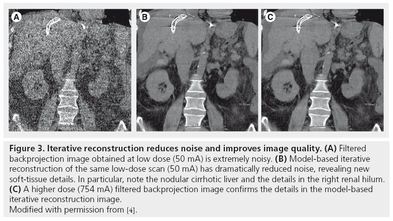 imaging-in-medicine-reduces-noise