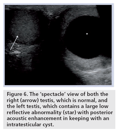 imaging-in-medicine-reflective-abnormality