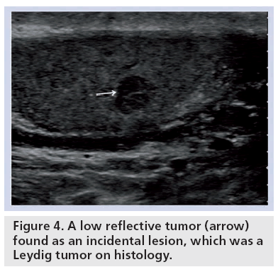 imaging-in-medicine-reflective-tumor