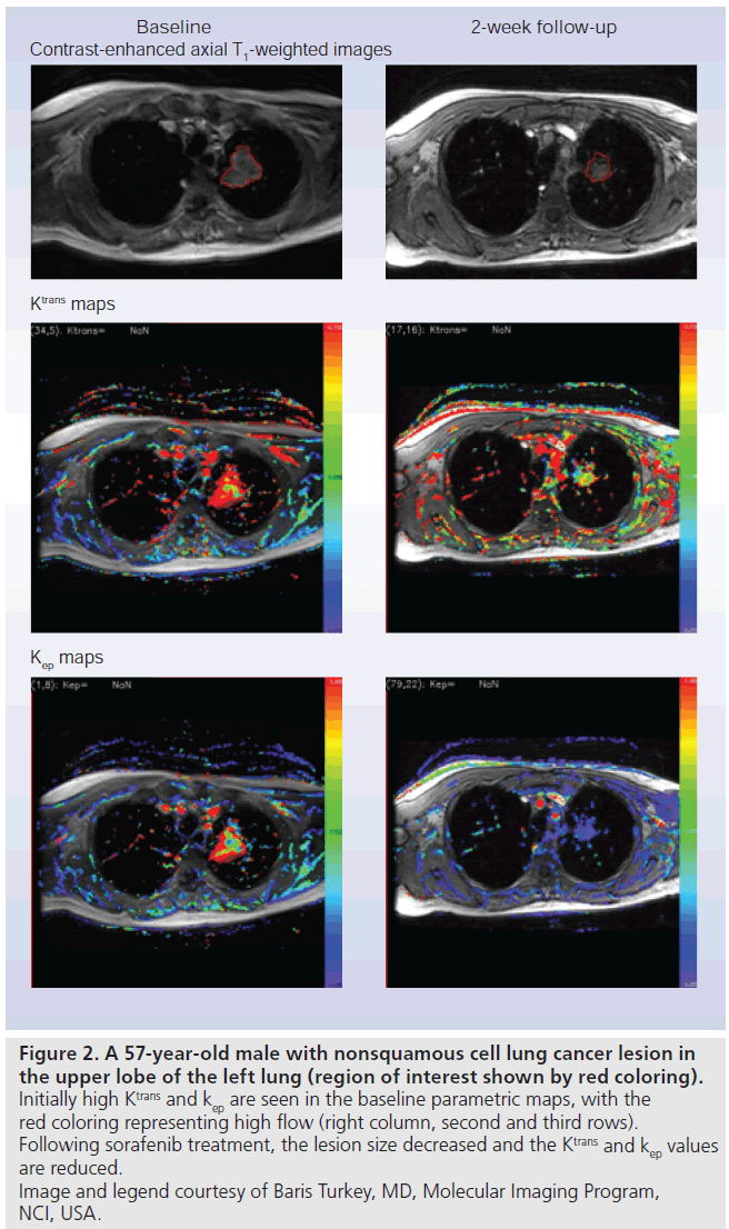 imaging-in-medicine-region-interest