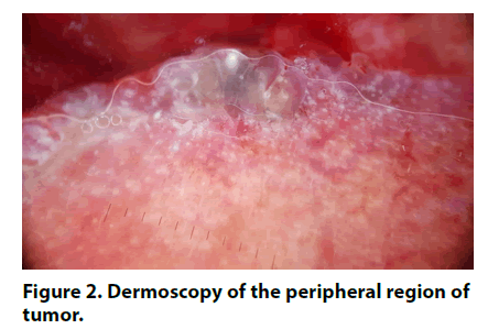 imaging-in-medicine-region-tumor