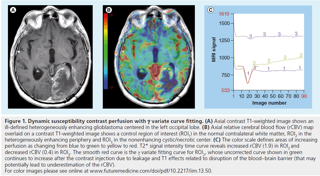 imaging-in-medicine-relative-cerebral