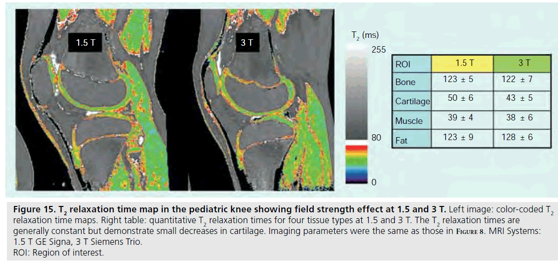 imaging-in-medicine-relaxation-times