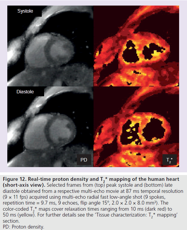 imaging-in-medicine-relaxation-times