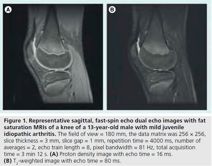 imaging-in-medicine-repetition-time