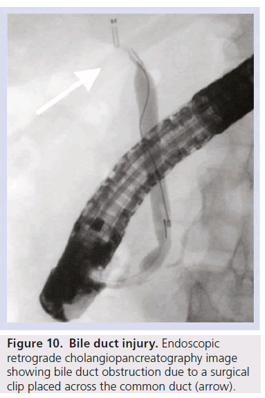 imaging-in-medicine-retrograde-cholangiopancreatography