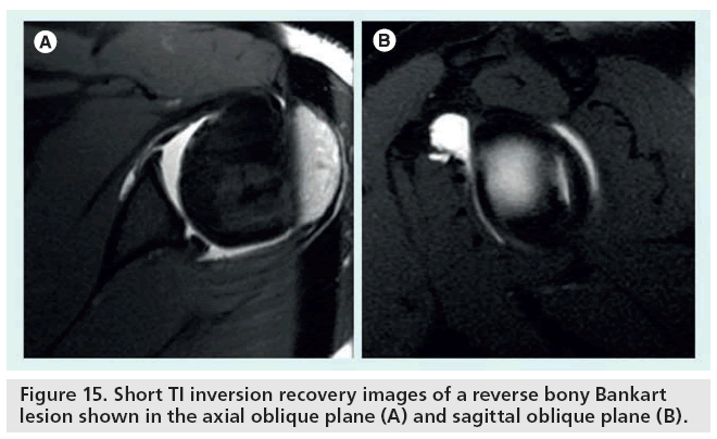 imaging-in-medicine-reverse-bony