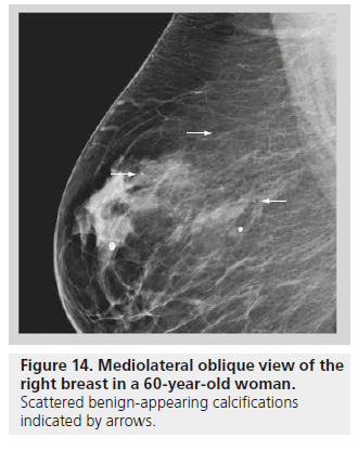 imaging-in-medicine-right-breast