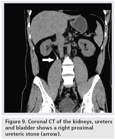 imaging-in-medicine-right-proximal