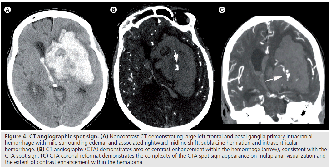 imaging-in-medicine-rightward-midline