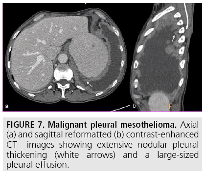 imaging-in-medicine-sagittal-reformatted