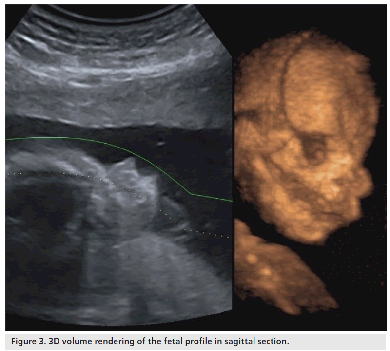 imaging-in-medicine-sagittal-section