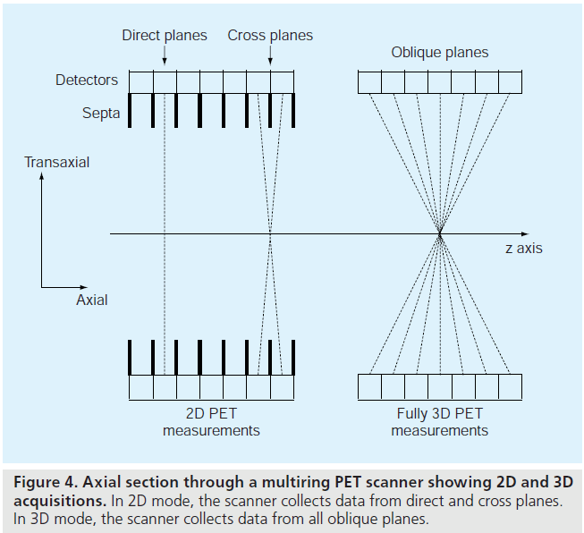 imaging-in-medicine-scanner-collects