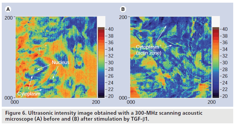 imaging-in-medicine-scanning-acoustic