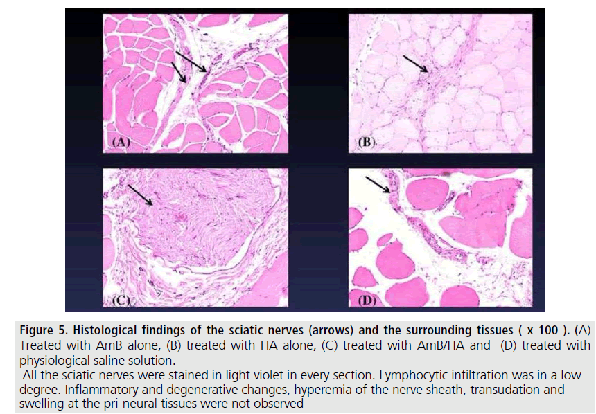 imaging-in-medicine-sciatic-nerves