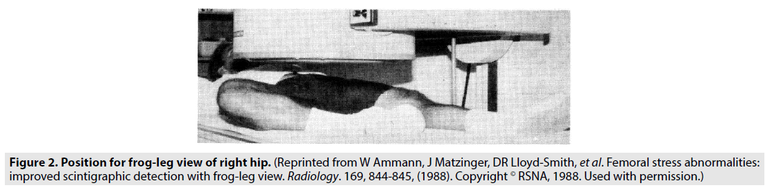 imaging-in-medicine-scintigraphic-detection