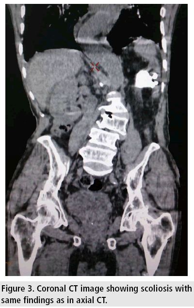 imaging-in-medicine-scoliosis