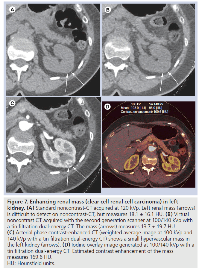 imaging-in-medicine-second-generation