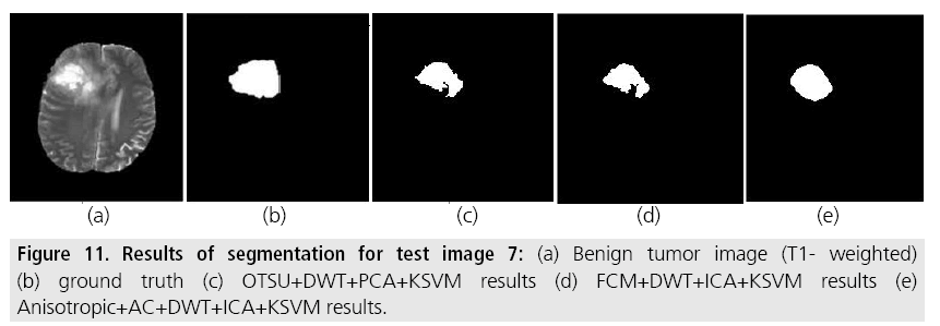 imaging-in-medicine-segmentation