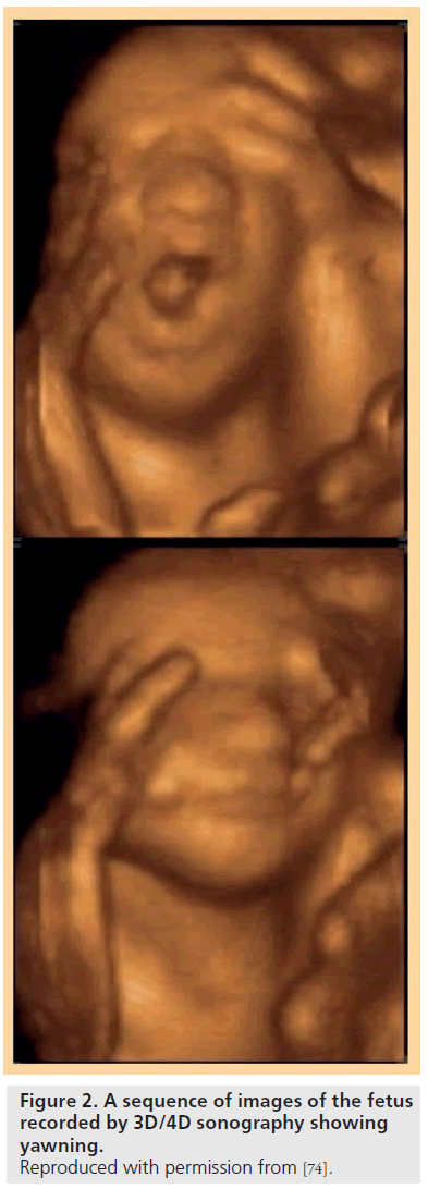 imaging-in-medicine-sequence-images