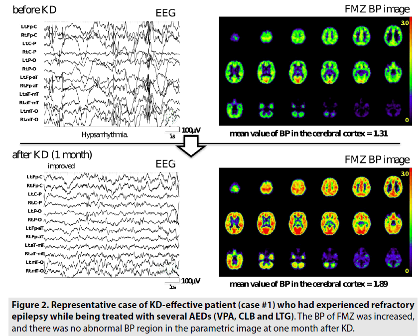 imaging-in-medicine-several-AEDs