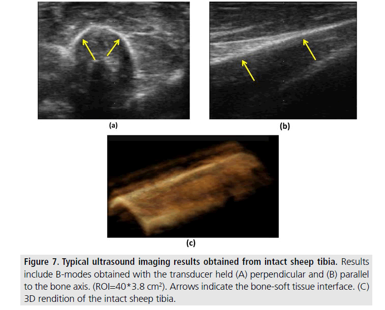 imaging-in-medicine-sheep-tibia