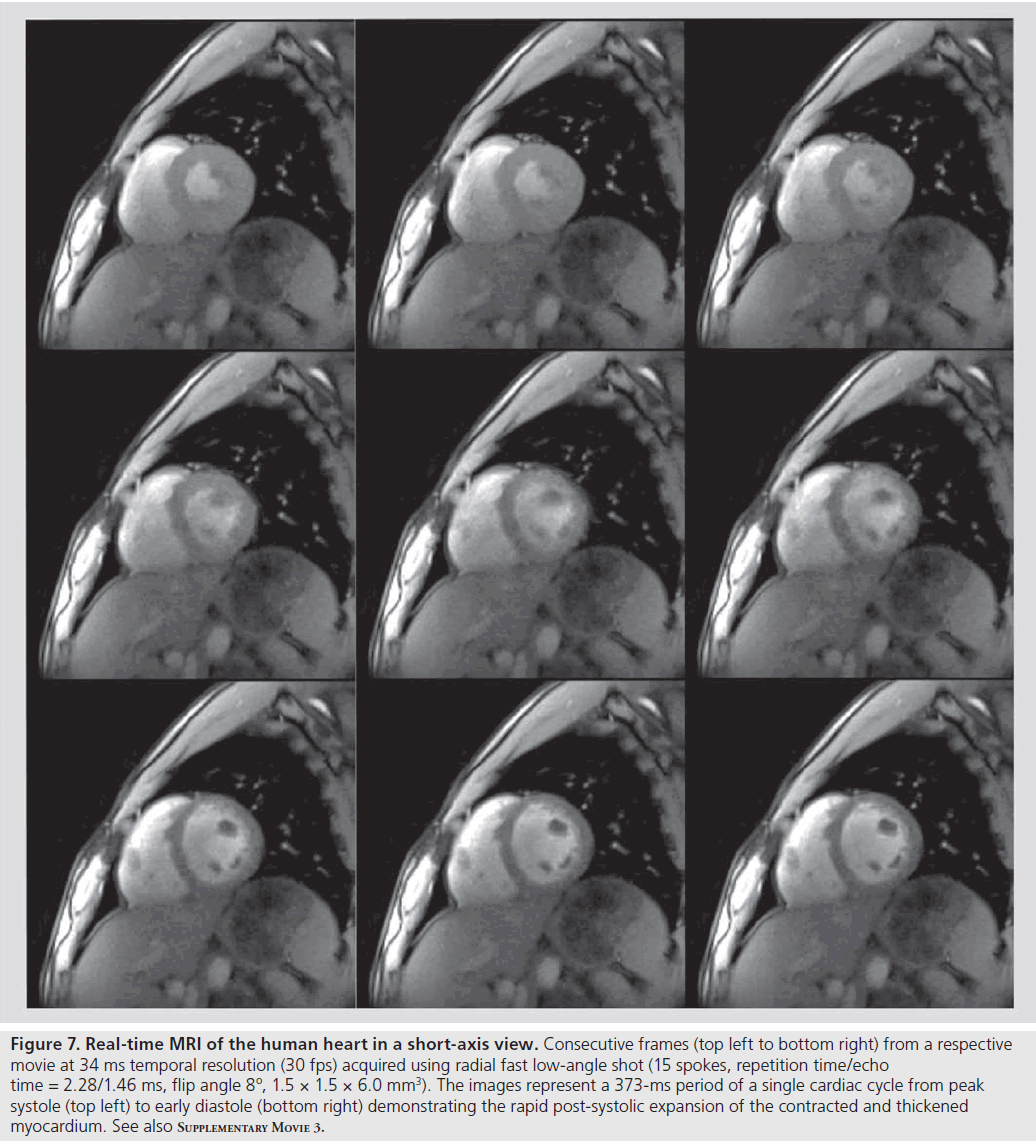 imaging-in-medicine-short-axis