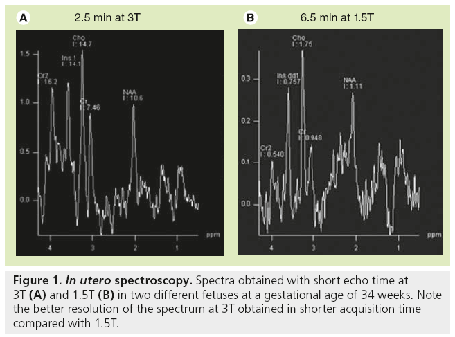 imaging-in-medicine-short-echo