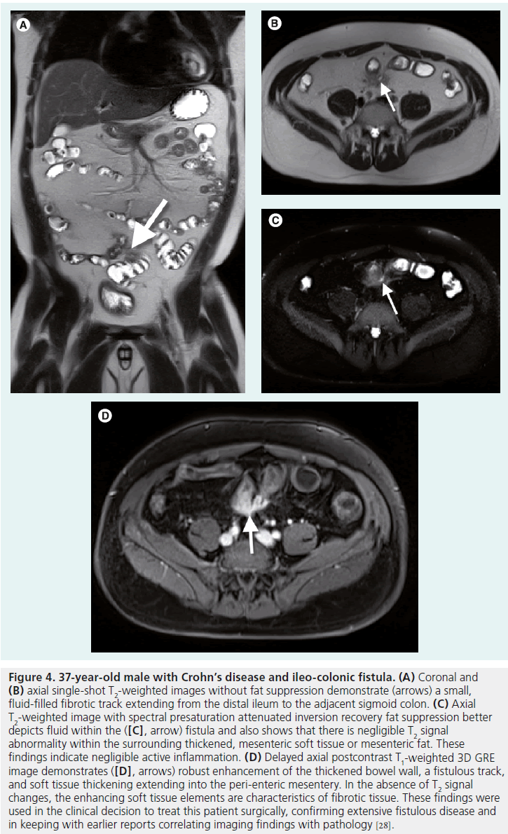 imaging-in-medicine-sigmoid-colon
