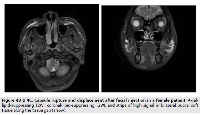 imaging-in-medicine-signal-bilateral