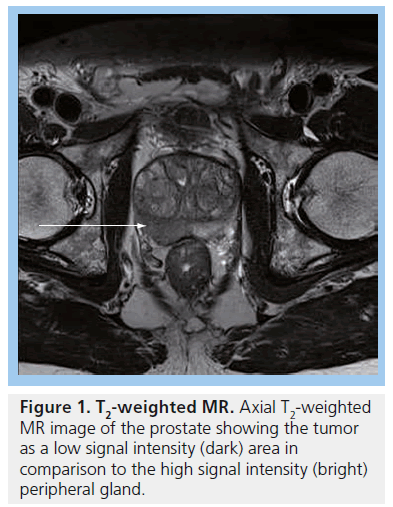 imaging-in-medicine-signal-intensity