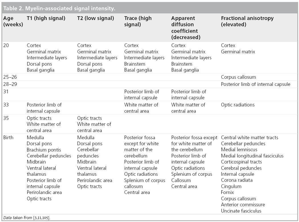 Table